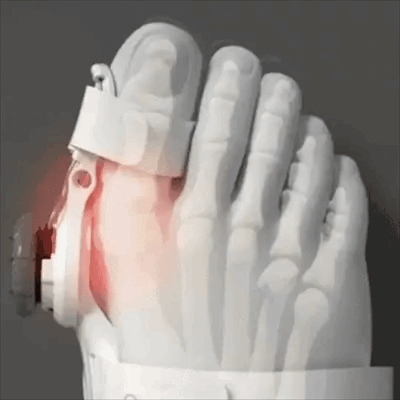 The Non-Surgical Reset Your Feet Have Been Begging For